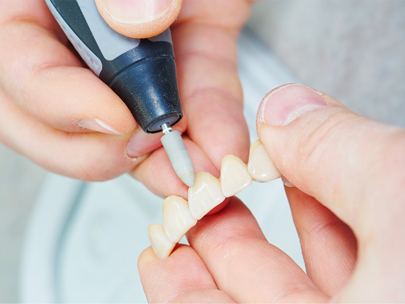 Dentista a Nove | Studio Dentistico Dental Fabris 27